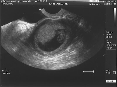 Baby%20Cummings%208%20weeks.jpg