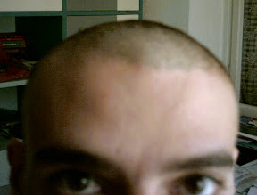 hairless me