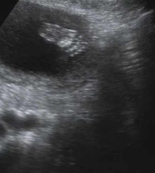 Picture 13.jpg