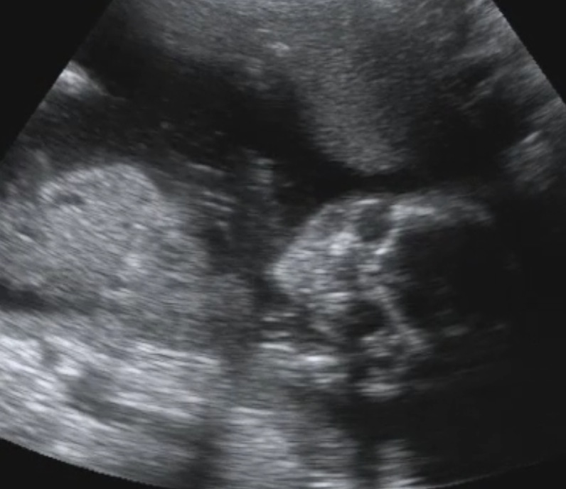 Picture 2.jpg