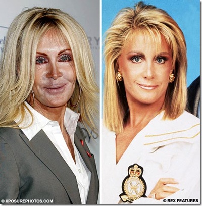 Knots Landing actress Joan Van Ark's attempts to hold back the years with cosmetic procedures appears to have backfired