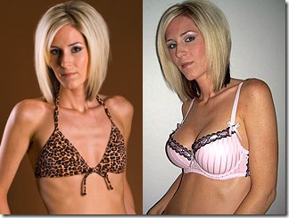 christina aguilera breast implants