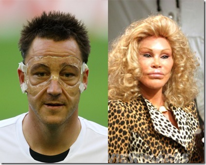 Bonus Picture 1: "John Terry's new face and Jocelyn Wildenstein's old face" 