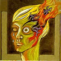 Migraines may alter brain