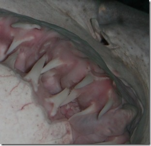 Ron's favorite - this is what happens when you go a dentist here...