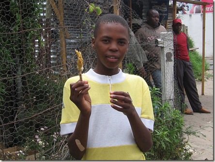 Boy with chicken foot