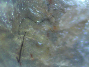 back lesion scab top 3 fiber 200x.jpg