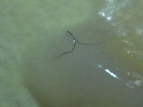 mucus fibers 60x.jpg