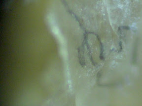 mucus fiber 200x.jpg