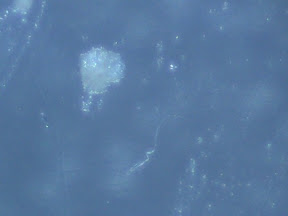 nasal sebum speck 60x.jpg