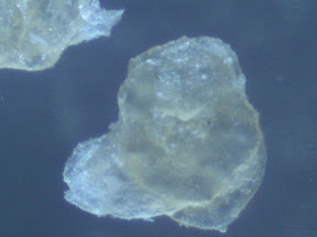 hand rash skin 60x.jpg