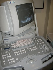 aparato para ecografia obstetrica