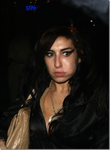 Amy Winehouse Impetigo picture