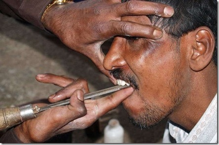 Street Dentists in India3