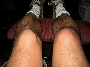swollen right knee