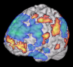 Brain-only-fMRI-journal.pone.0001679.g003.png